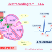 Electrocardiogram　 ECG