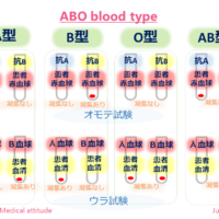 ABO blood type