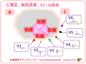 心電図　胸部誘導　V1～V6誘導