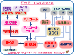肝疾患　Liver disease