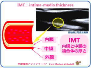 IMT：intima-media thickness